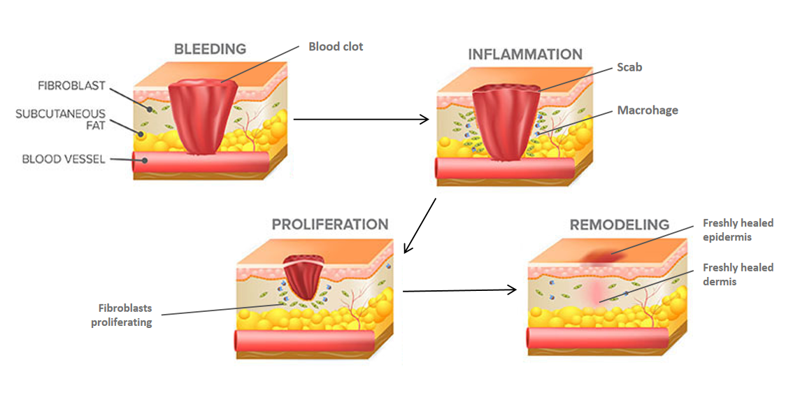 process of skin injury